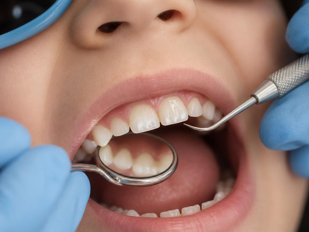 close-up of a child's front tooth with a white spot before ICON, Park View treatment room